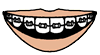 Smiling Mouth with Braces Clipart